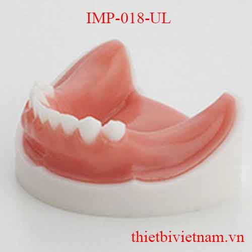 IMP-018-UL IMPLANT LOWER BASIC TRAINING MODEL WITH GINGIVAE