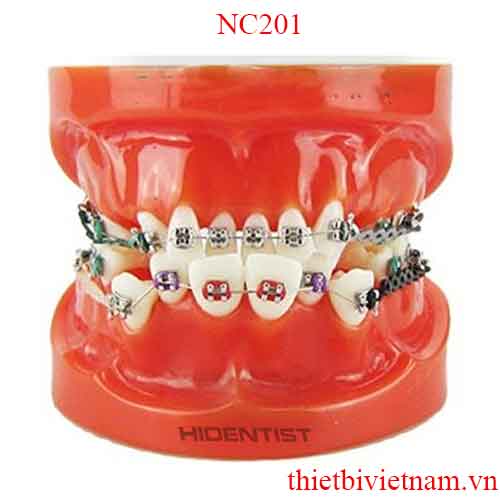 MẪU HÀM TƯ VẤN CHỈNH NHA MẮC CÀI BẰNG NHỰA CỨNG MÀU SÁP NC201